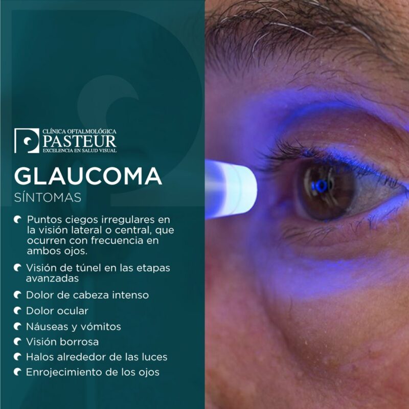 Glaucoma, causa de ceguera