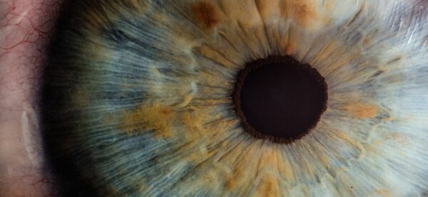 Los rayos ultravioletas pueden afectar la salud de tus ojos | Clínica Oftalmológica Pasteur